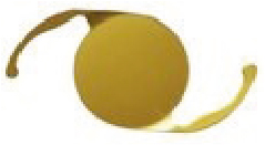 photo_cataract1.jpg
