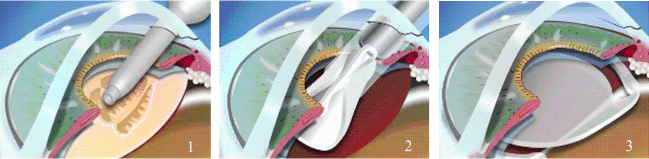 img1395609_1.gif