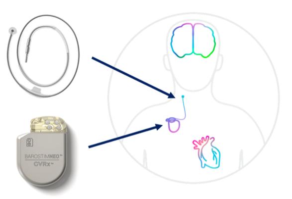 Diagram
Description automatically generated
