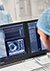 This photo shows someone working with the Philips Azurion image-guided therapy platform 