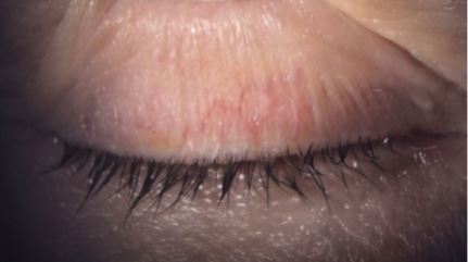 Blood vessels image.jpg