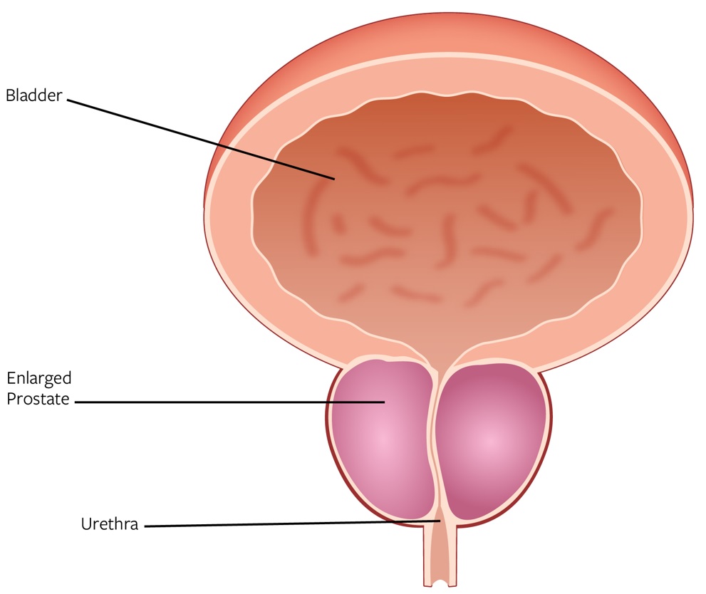 prct-20211231_g3.jpg