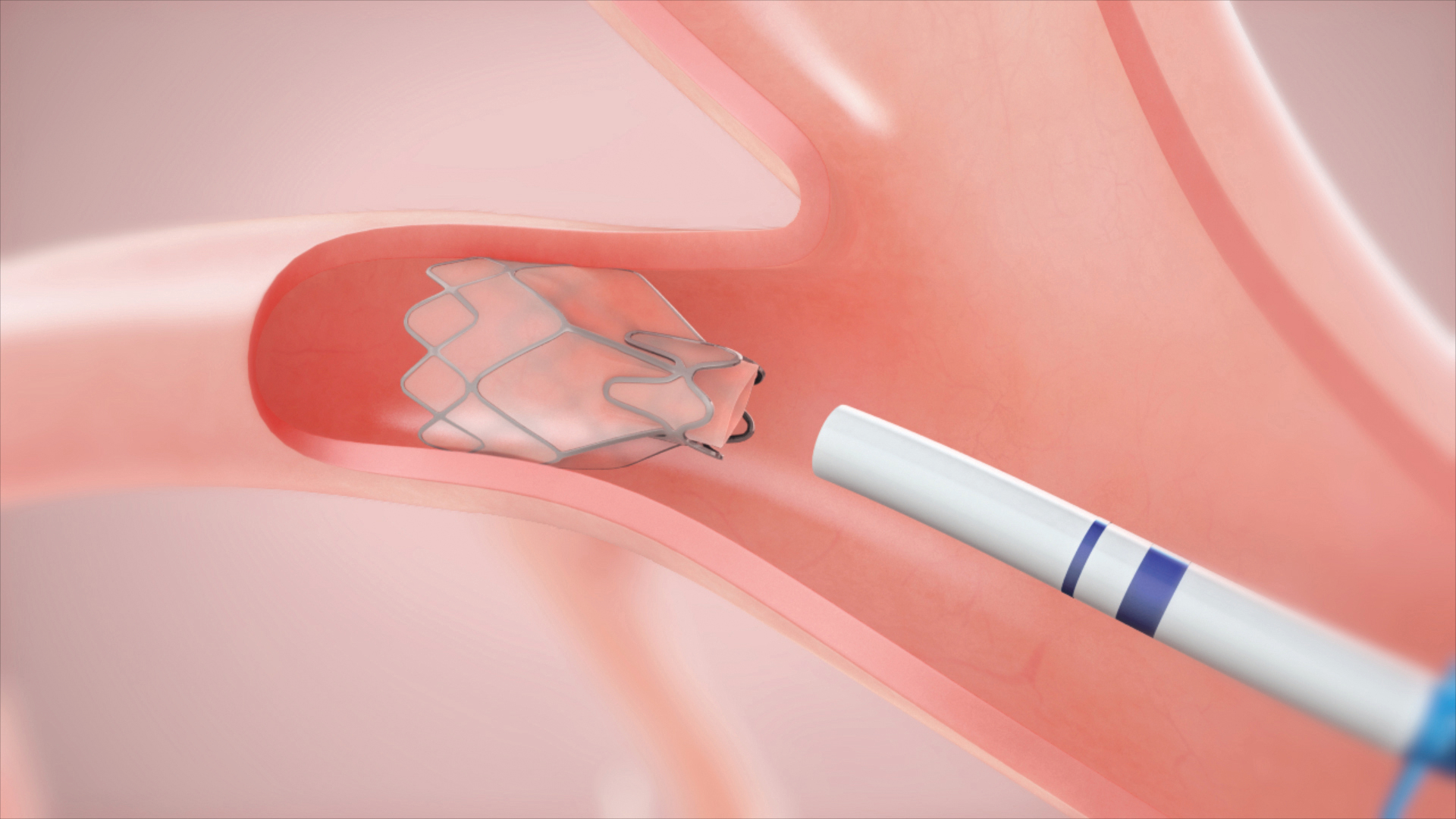 lung-20211231_g8.jpg