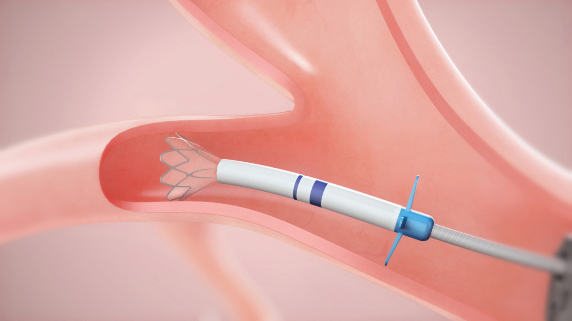 lung-20221231_g5.jpg