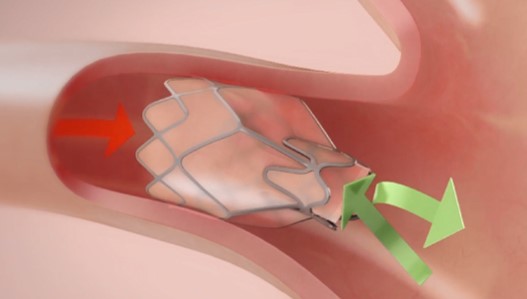 lung-20221231_g7.jpg