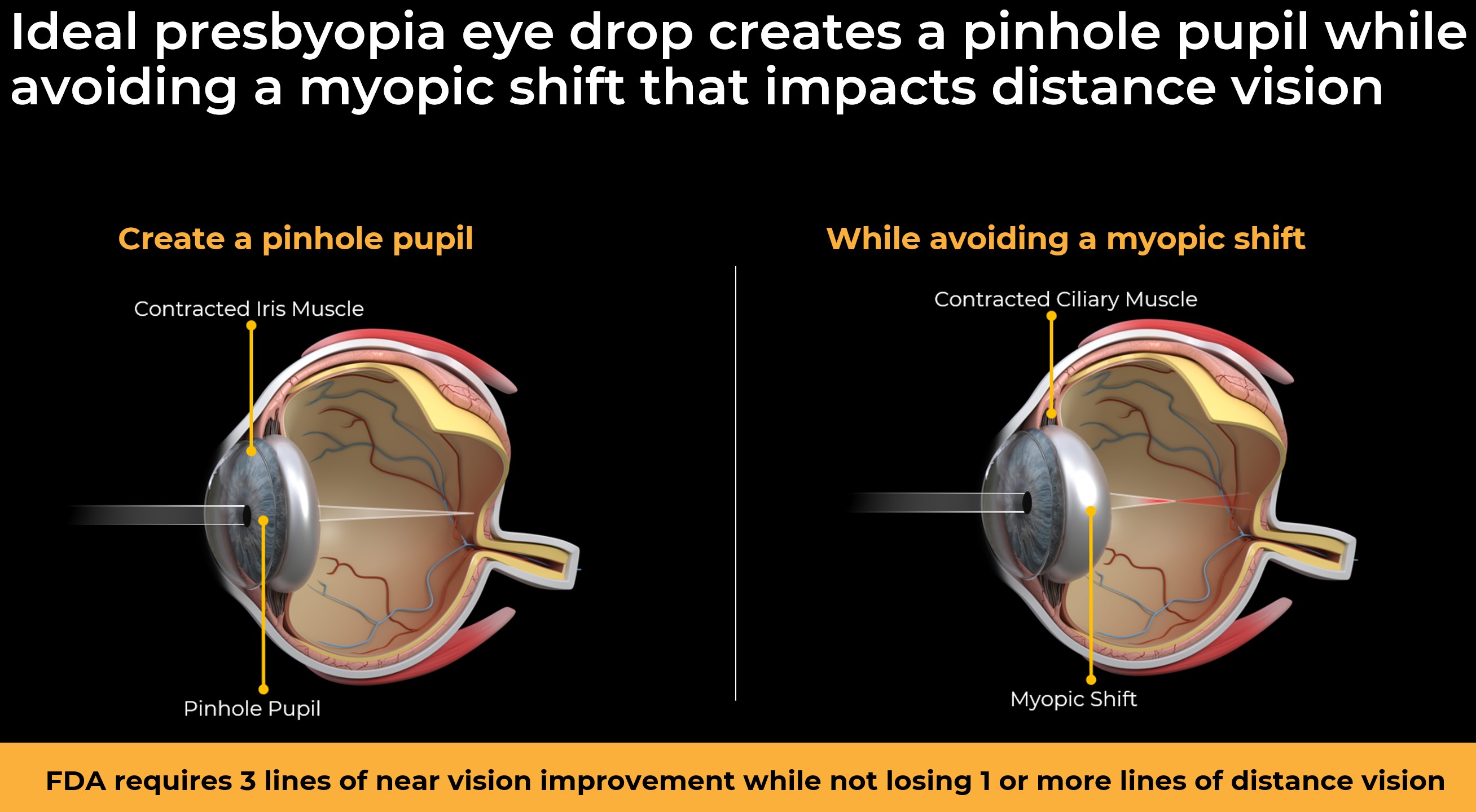 Ideal presbyopia eye drop.jpg